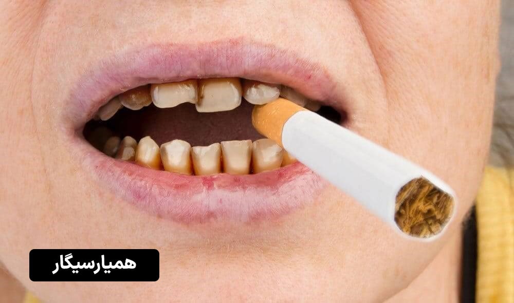 دندان های فرد سیگاری