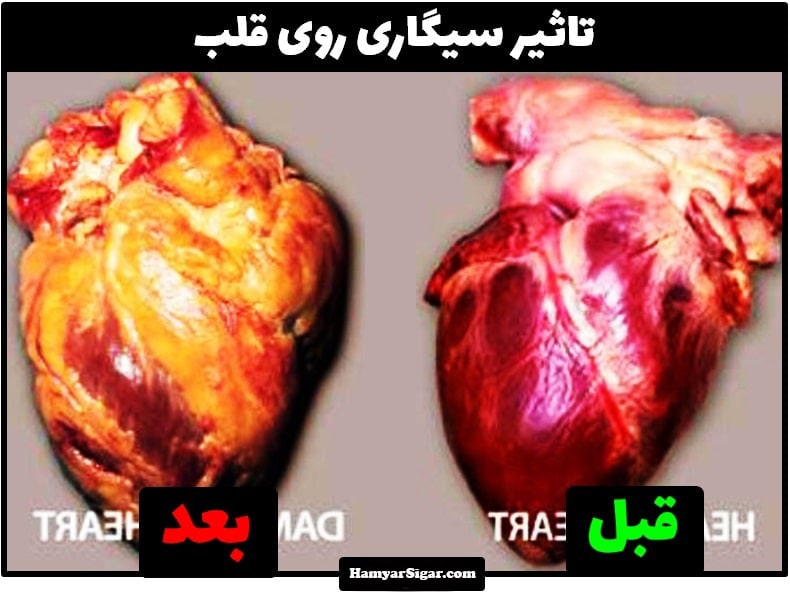 تاثیر سیگار روی قلب