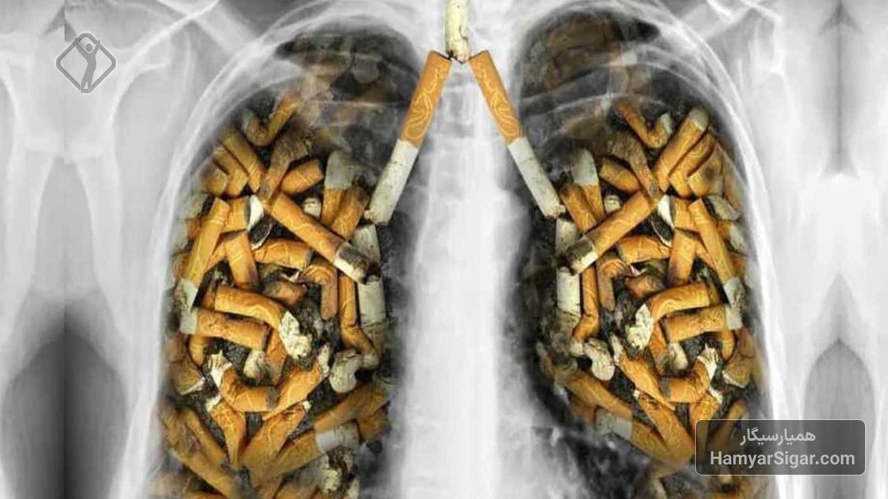 علائم سرطان ریه در سیگاری ها